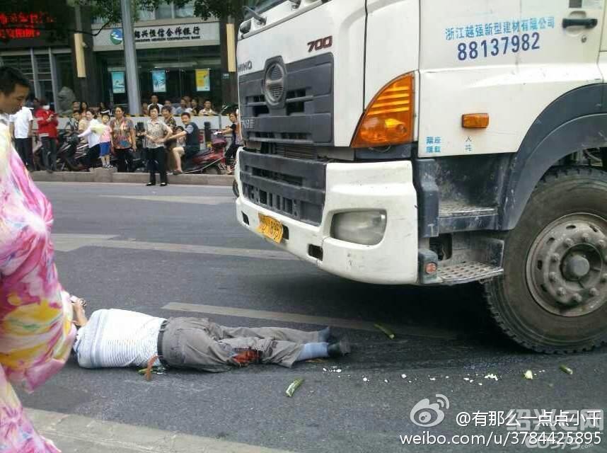 车祸猛如虎,大车压扁了受害人的腿